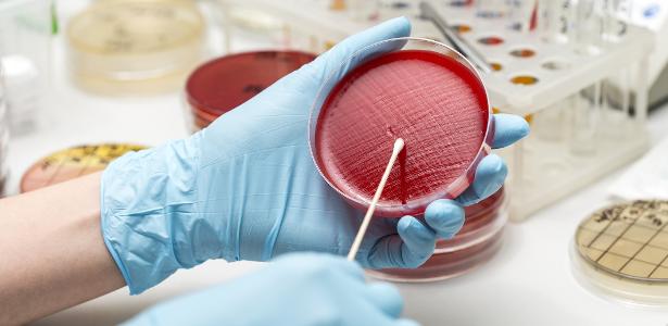 IA supera 94% dos virologistas em teste difícil criado pela elite da área