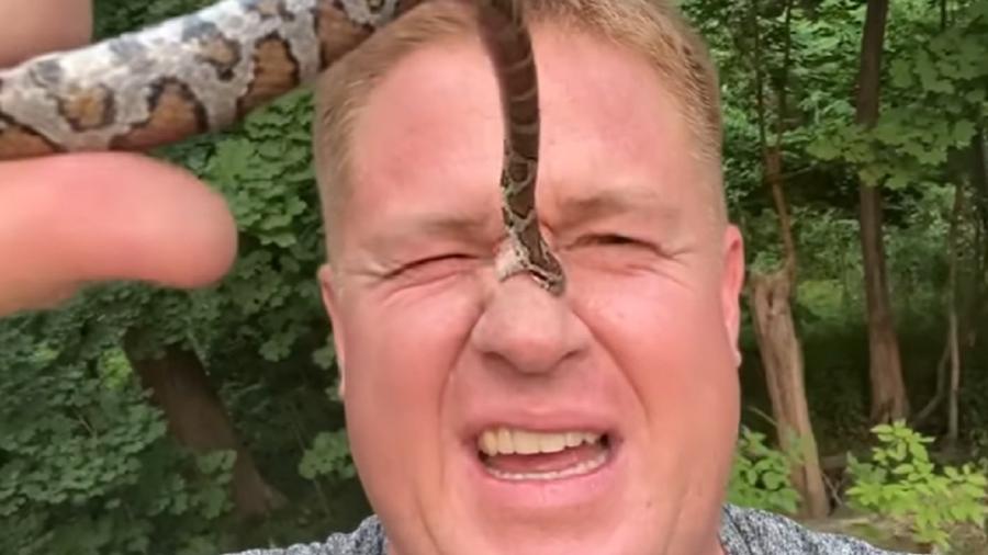 Jesse Rothacker mostra que a cobra o mordeu o total de 53 vezes - Reprodução/Youtube