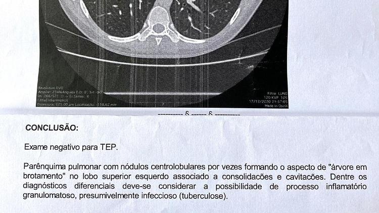 diagnótisco de tb - Arquivo pessoal - Arquivo pessoal