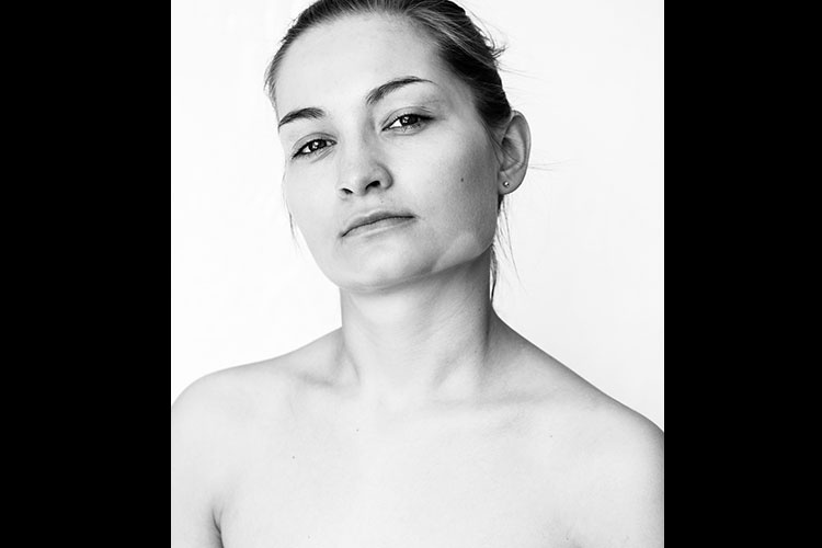 Modelos com vitiligo - Divulgação/Julia Kaczorowska