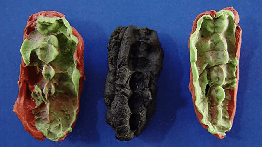 Gomas mascadas há quase 10 mil anos contêm saliva e marcas de dentes claramente visíveis