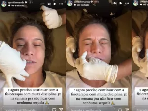 Fernanda Gentil mostra tratamento para Paralisia de Bell: 'Dói pra cacet*'