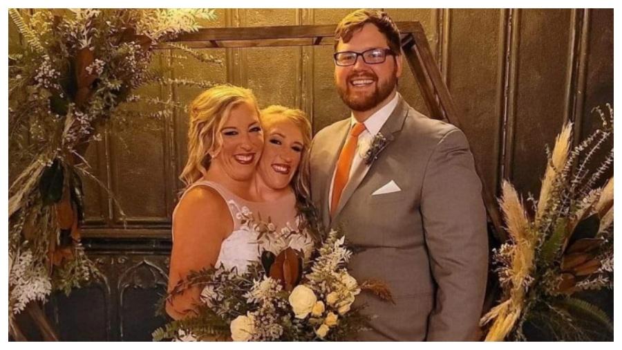 Abby Hensel casou com o ex-militar Josh Bowling - Reprodução