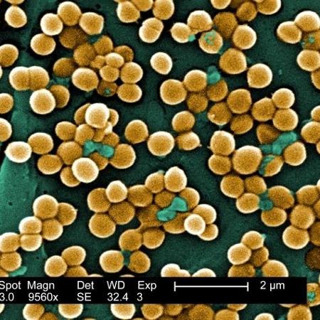 O Staphylococcus aureus é uma causa comum de infecções bacterianas adquiridas em hospitais