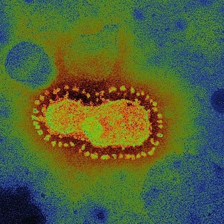 Coronavírus pode estar causando formação anormal de coágulos em pacientes - Getty Images via BBC