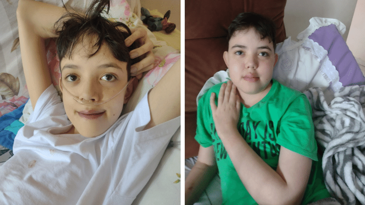 Antes e depois de Diego: à esquerda, um mês antes do transplante; à direita, dois meses depois