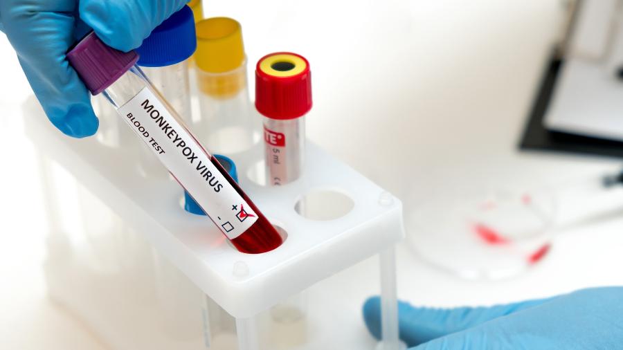 Entenda quais os protocolos para diagnosticar a varíola dos macacos - iStock