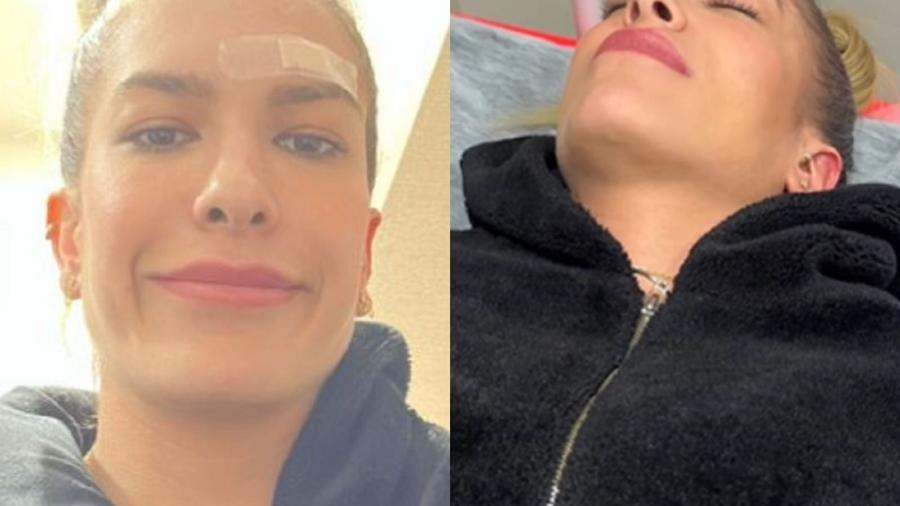 Lore Improta mostra atendimento no hospital após acidente doméstico  - Reprodução/Instagram