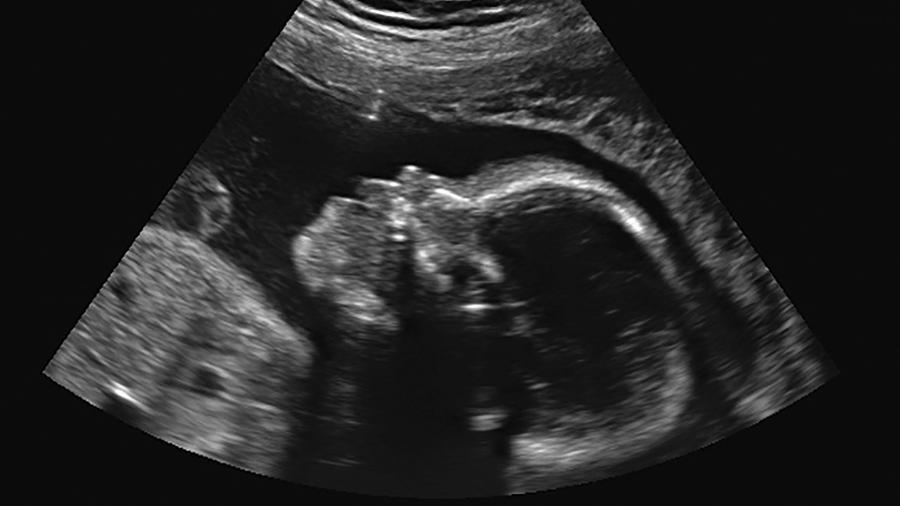A partir da 10ª semana de gestação, o feto pode perceber e reconhecer o batimento cardíaco da mãe - Getty Images