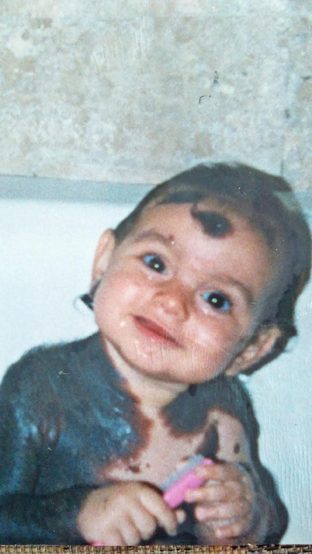 Quando Beatriz era um bebê, seus pais tiveram dificuldades em encontrar um especialista que oferecesse tratamento adequado para a filha - HotSpot Midia