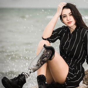 Chiara Bondi, de 17 anos, desfilará na passarela do concurso com uma prótese na perna esquerda, amputada após um acidente de trânsito