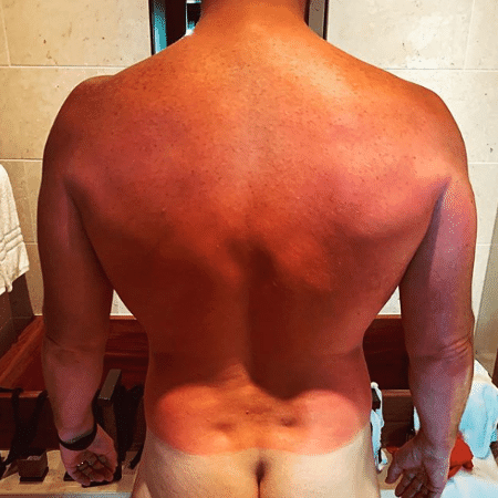 Chris Pratt mostra o bumbum branco durante lua de mel - Reprodução/Instagram