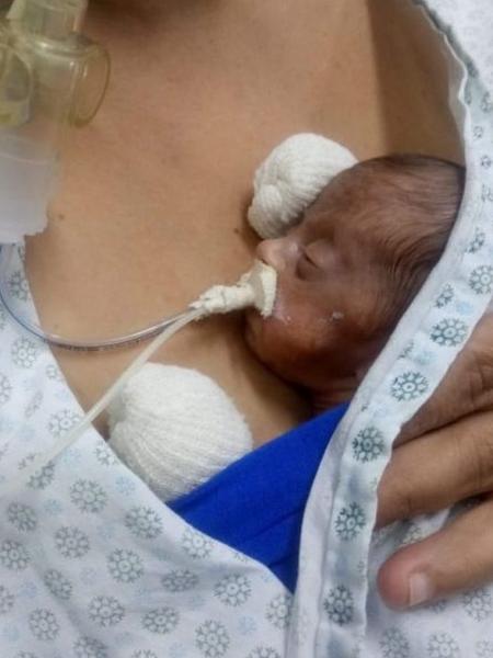 Isabella nasceu aos cinco meses, pesando 560 g - Acervo pessoal