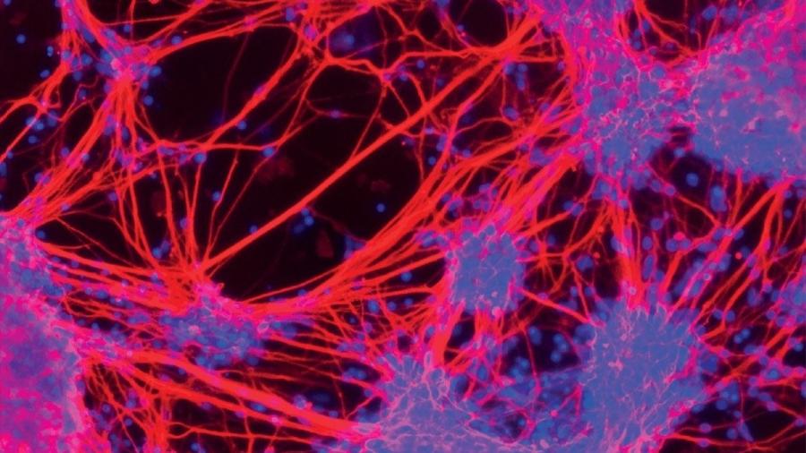 Neurônios gabaérgicos humanos produzidos em laboratório; o núcleo das células aparece em azul - Talita Glaser / USP (Universidade de São Paulo)
