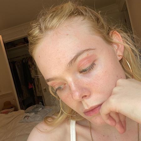 "Eczema, mas finjam que é sombra", brincou Elle; seguidoras se disseram representadas pela foto: "Me sinto vista" - Reprodução/Instagram