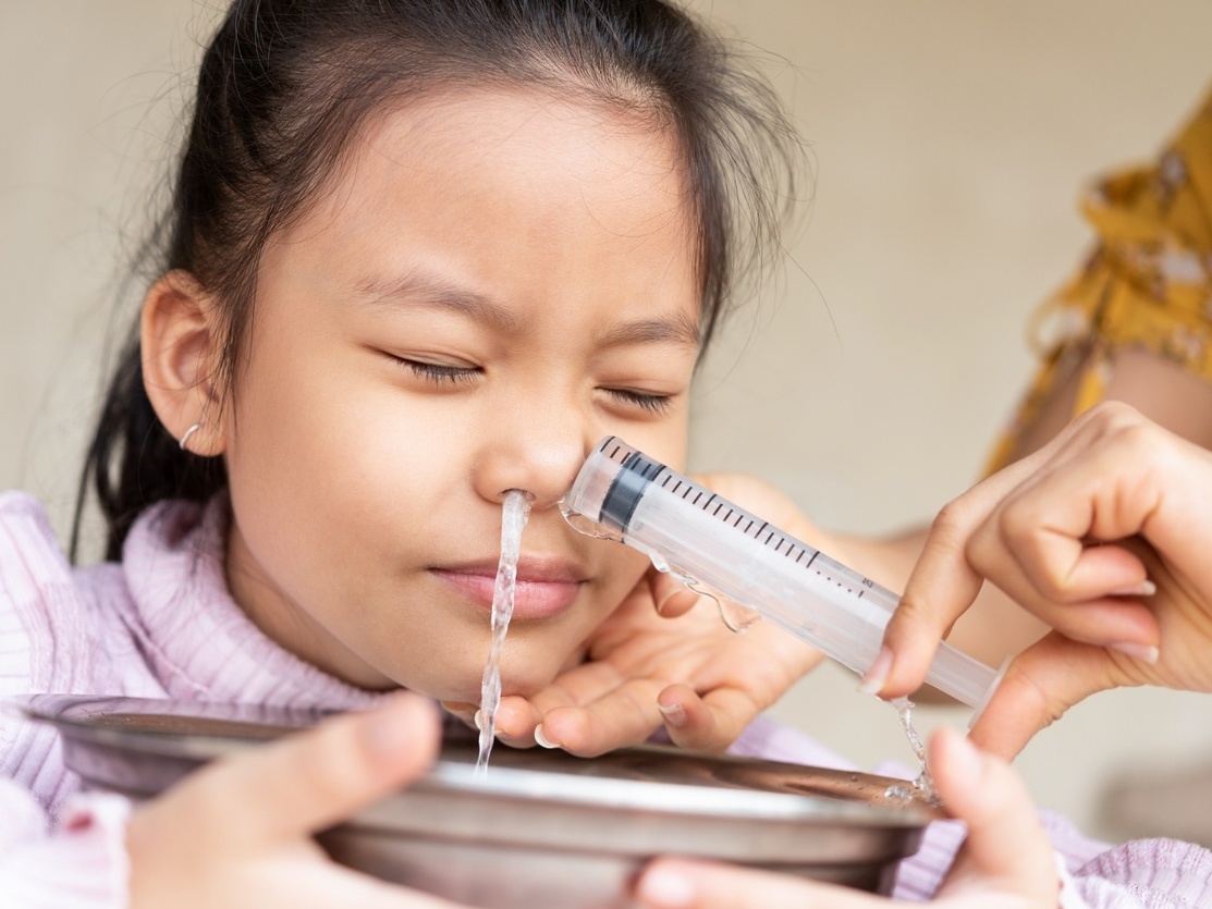 LAVAGEM NASAL SERINGA: Como fazer lavagem nasal em bebês e crianças? Veja o  que dizem especialistas
