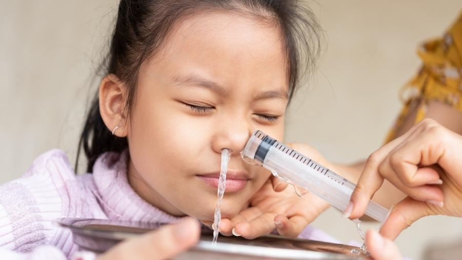 Lavagem nasal em criança; saiba a forma correta de fazer em casa - Getty Images/iStockphoto