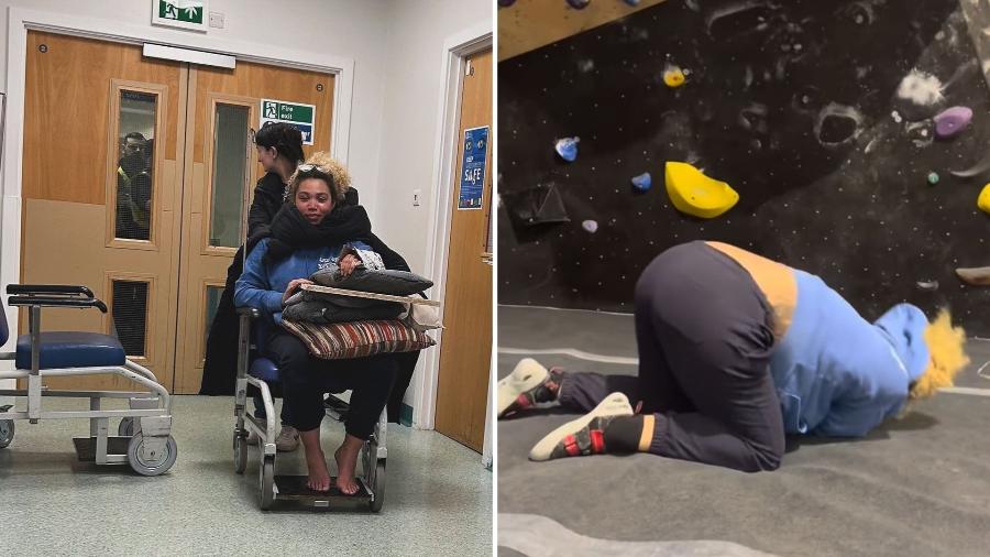 Ruby Barker mostra queda de escalada e foto em hospital 