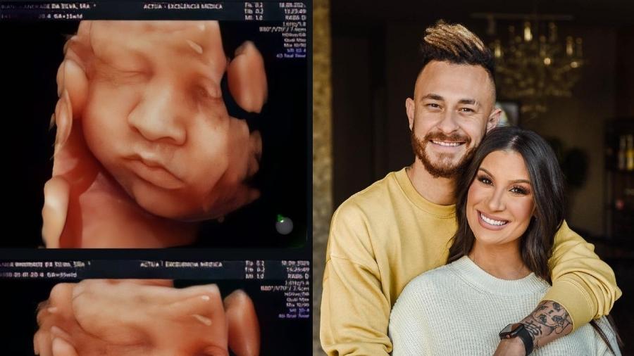 Bianca Andrade e Fred fizeram hoje uma ultrassonografia 4D e puderam ver o rosto do bebê - Reprodução/Instagram