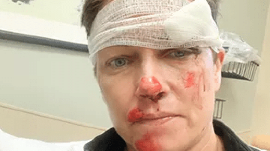 Stephanie Gosk se feriu durante prova de ciclismo - Reprodução