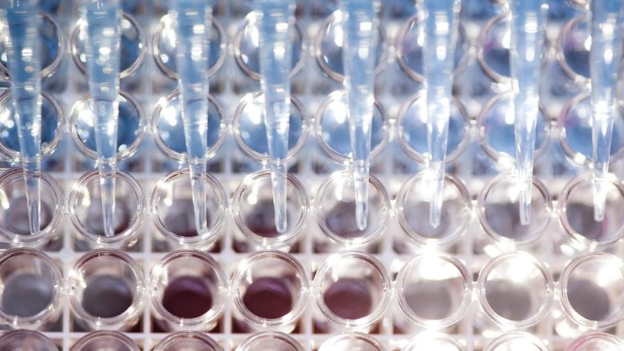 Não há consenso científico de que algum dos 48 testes laboratoriais aprovados consiga diferenciar as infecções das causadas pelo vírus da dengue - Pesquisa Fapesp/Léo Ramos Chaves