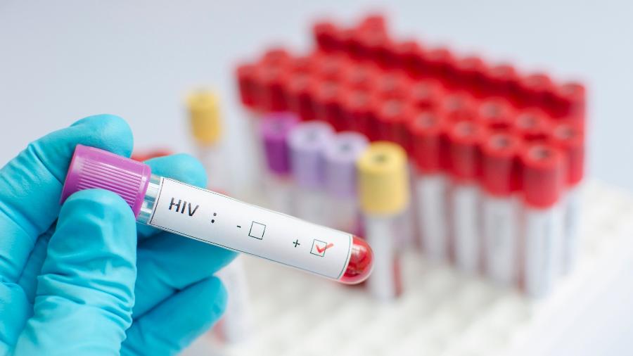 Até hoje, uma minoria de infectados com o HIV demonstrou ser capaz de controlá-lo sem tratamento com antirretrovirais - Getty Images/iStockphoto
