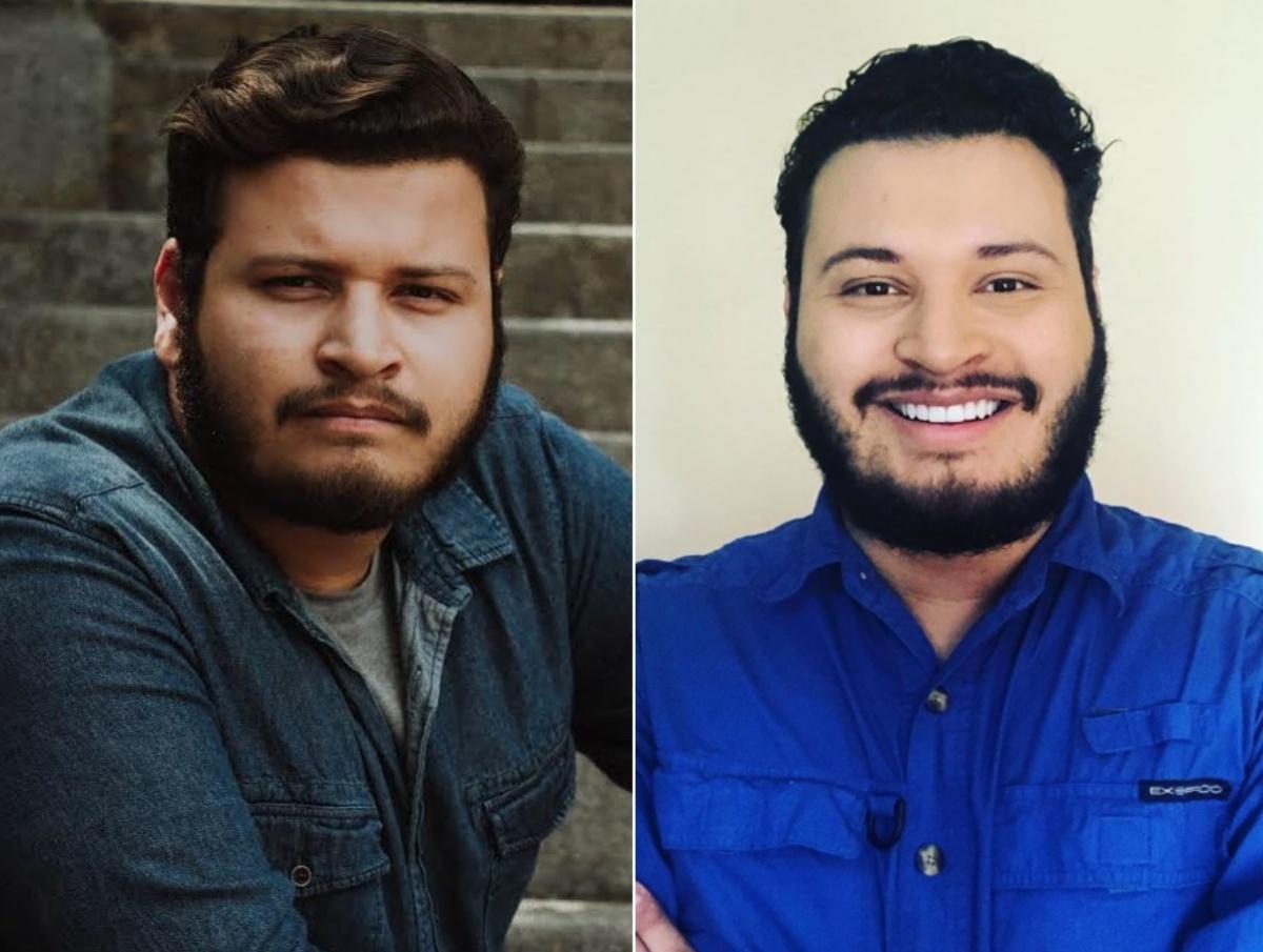 Victor Hugo antes e depois da harmonização facial - Reprodução/Instagram