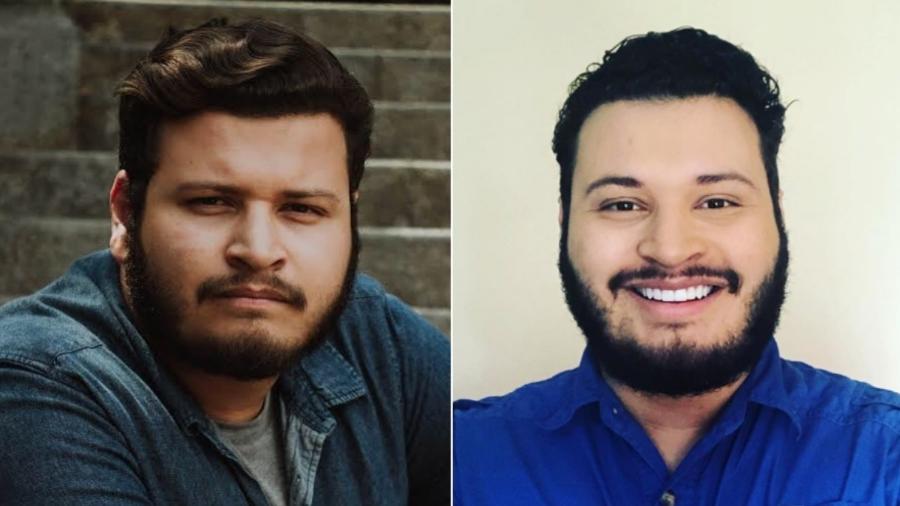 Victor Hugo antes e depois da harmonização facial - Reprodução/Instagram