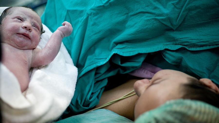 Em 27 anos, a taxa de partos por cesárea quase dobrou na Alemanha - iStock