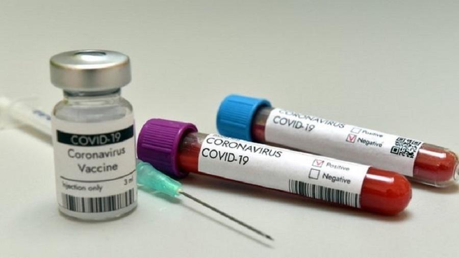 Testes que medem anticorpos contra o coronavírus não são suficientes para determinar a efetividade de uma vacina - Getty Images
