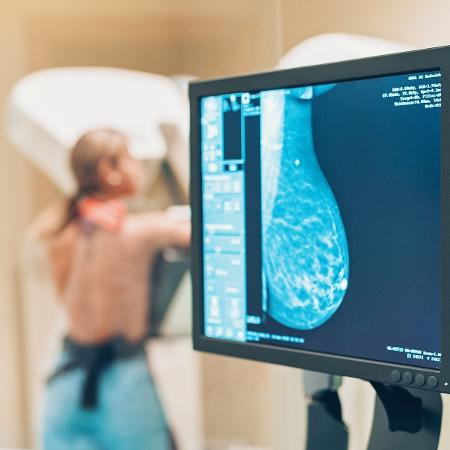 Monitores para diagnóstico de câncer de mama seguem requisitos específicos - Getty Images