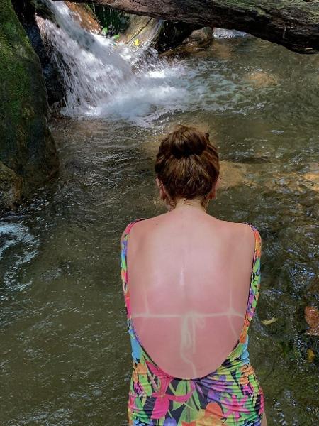 Bruna Linzmeyer e suas costas vermelhas de sol - Reprodução/ Instagram