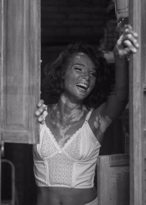 Eliane Medeiros Foto PB, modelo vitiligo da C&A Arquivo Pessoal - Reprodução/ Facebook - Reprodução/ Facebook
