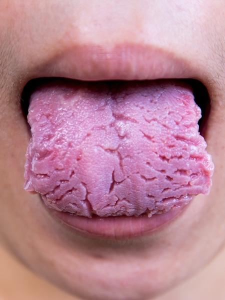 iStock