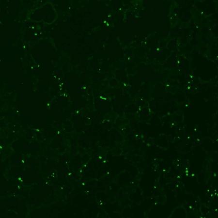 Células em apoptose (verde) no tecido pulmonar de camundongos DBA/2 que morreram de síndrome respiratória aguda associada à malária - Sabrina Epiphanio/USP