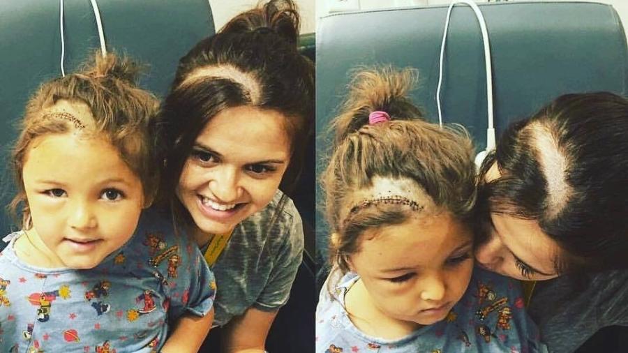 Jamie, mãe de Faith, raspou parte do cabelo ao ver filha triste com cicatriz pós-operatória - Reprodução/Facebook/LoveWhatMatters