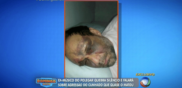 Ricardo Costa contou detalhes da agressão que sofreu do cunhado no início do mês - Reprodução/TV Record