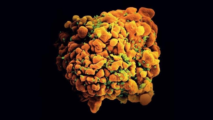 Microscopia eletrônica de linfócito T CD4, responsável por ativar outras células de defesa, infectado pelo HIV (esferas verdes) - Niad via Agência Fapesp