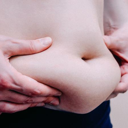A gordura é coletada sob a pele e então retransplantada no mesmo paciente  - Getty Images