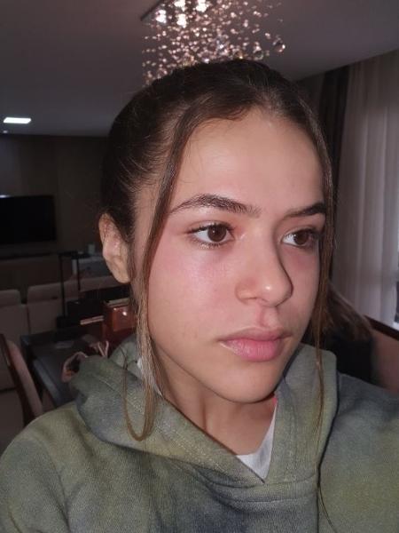 Maisa Silva mostra reação alérgica de cosmético - Reprodução/Twitter