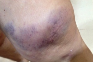 Melissa Munhoz - Reprodução/Facebook/melissa.munhoz,27 - Reprodução/Facebook/melissa.munhoz,27