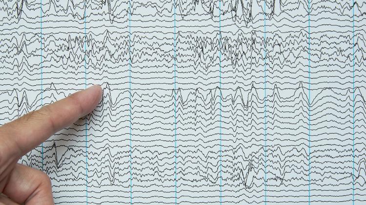 Diferentes frequências de oscilações neurais indicam diferentes tipos de atividade cerebral