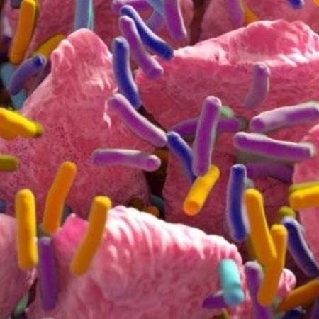A identificação das bactérias é uma estratégia diagnóstica e terapêutica para o câncer colorretal, que tem alto índice de cura quando identificado precocemente - Getty Images