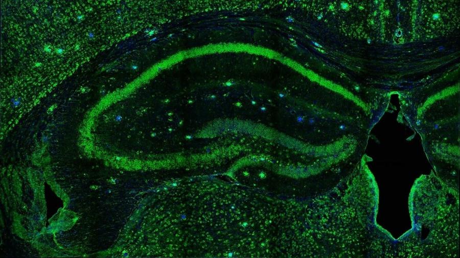 Oligômeros do peptídeo beta-amiloide (áreas verdes mais brilhantes) se acumulam em região do cérebro de camundongos associada à formação de memória - Mauricio Martins Oliveira / UFRJ