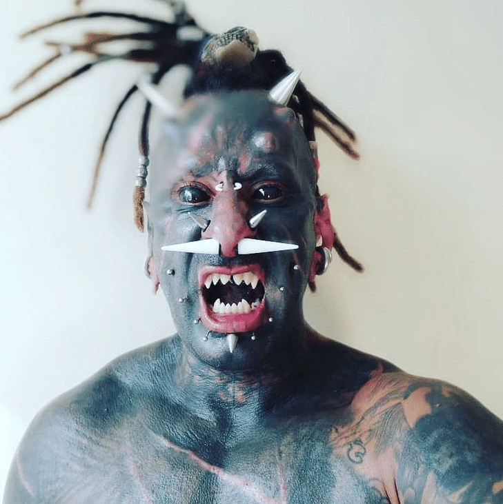 Aí entraram também alterações nos dentes - Reprodução/Instagram