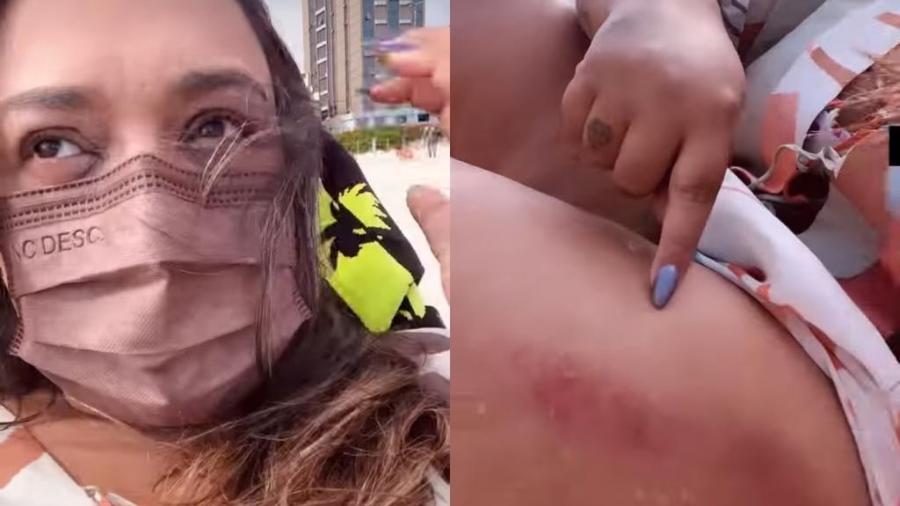Preta Gil conta que sofreu acidente em praia do Rio de Janeiro - Reprodução/Instagram