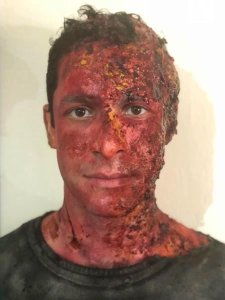 Rainer Cadete "desfigura" rosto para viver bandido na segunda temporada de "Carcereiros" - Divulgação - Divulgação