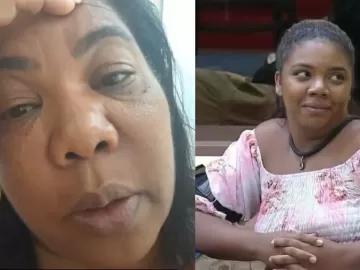 Mãe de Raquel Brito fala sobre estado da filha e explica mal-entendido