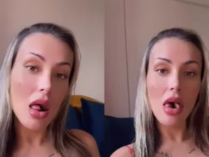 Andressa Urach mostra recuperação de bifurcação da língua: 'Muito doloroso'