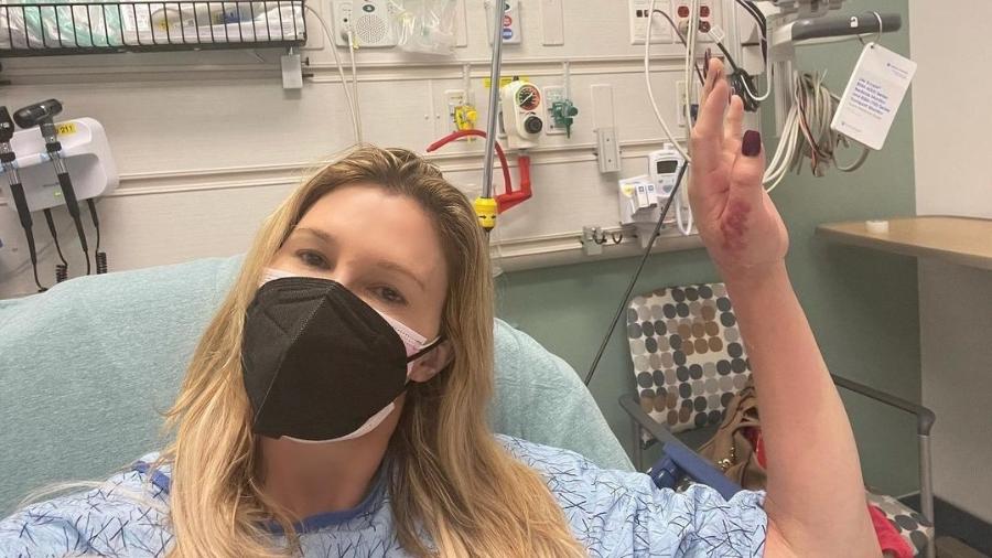 Brandi Glanville mostra picada na mão que quase a fez perder braço - Reprodução/Instagram @brandiglanville